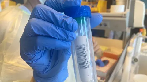 PCR 2
